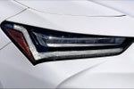2025 Acura TLX Technology Package